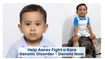 Deputy-Commissioner-Leads-Public-Appeal-To-Save-24-month-old-Aarav-Fighting-A-Rare-Genetic-Disorder-